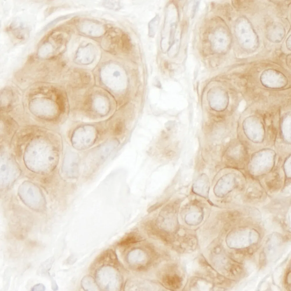Rabbit anti-GIT1 IHC Antibody, Affinity Purified