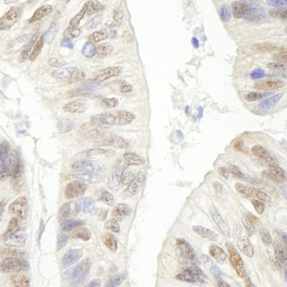 Rabbit anti-ERCC5/XPG IHC Antibody, Affinity Purified