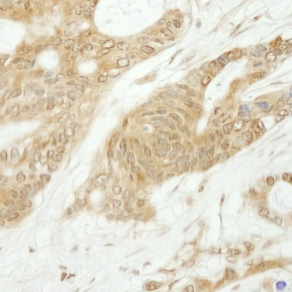 Rabbit anti-Notch1 IHC Antibody, Affinity Purified