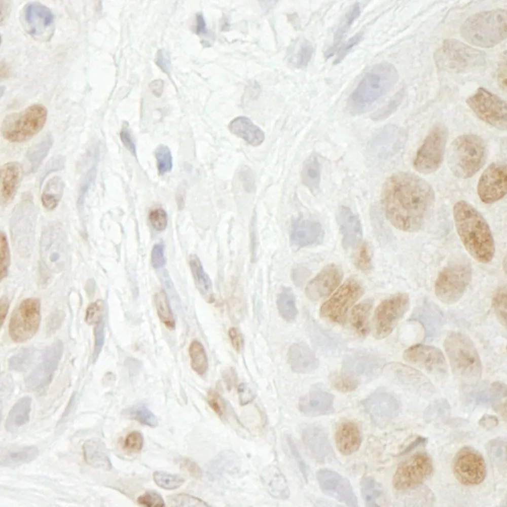 Rabbit anti-GIT2 IHC Antibody, Affinity Purified