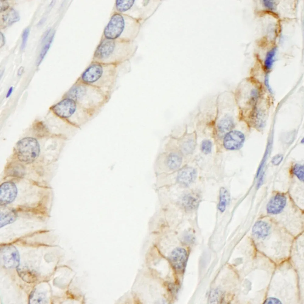 Rabbit anti-KIAA0528 IHC Antibody, Affinity Purified