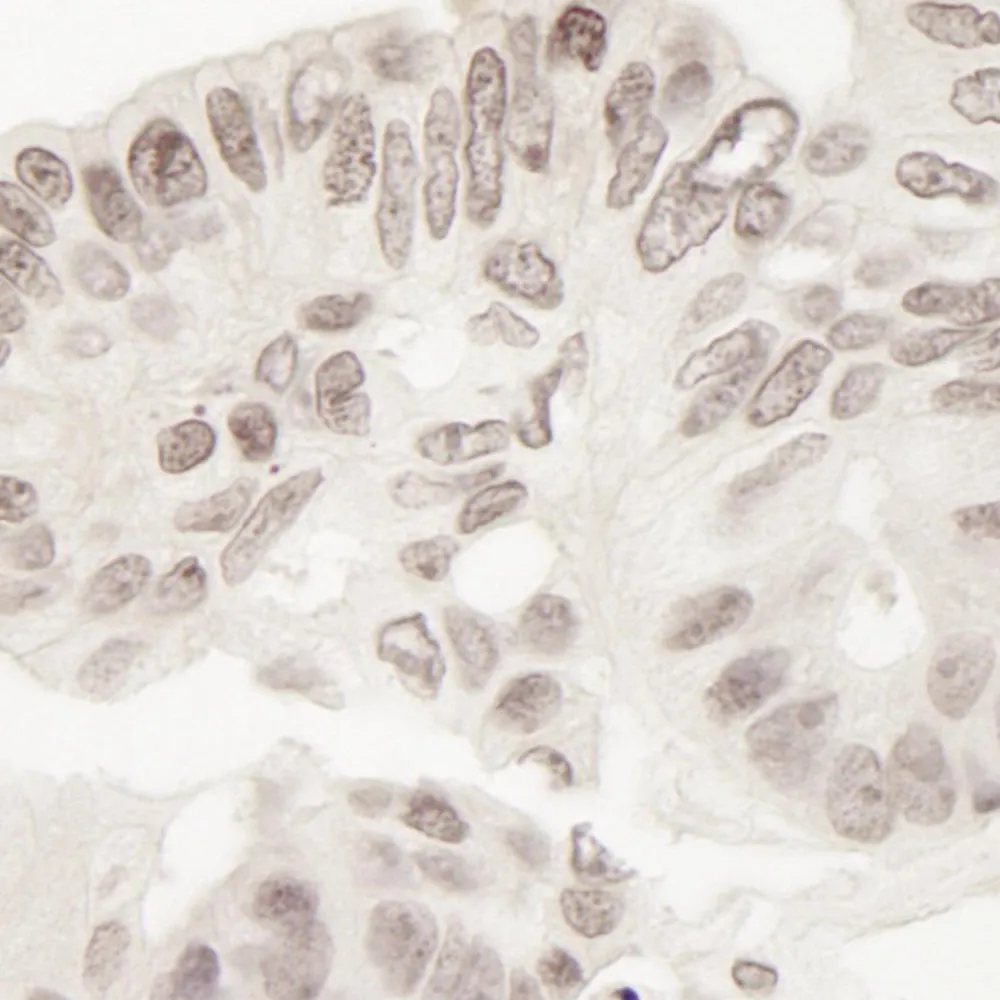 Rabbit anti-TORC2 IHC Antibody, Affinity Purified