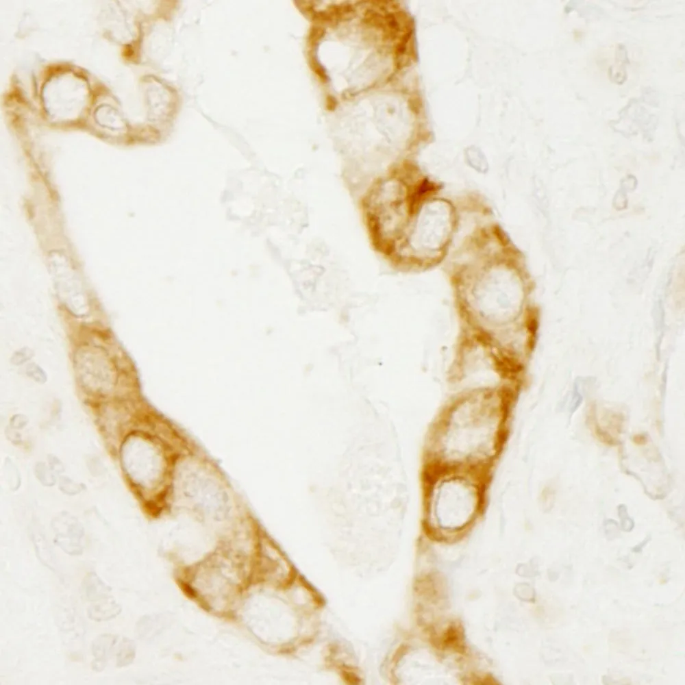 Rabbit anti-PKD2 IHC Antibody, Affinity Purified