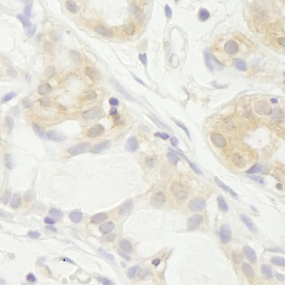 Rabbit anti-eIF2A IHC Antibody, Affinity Purified