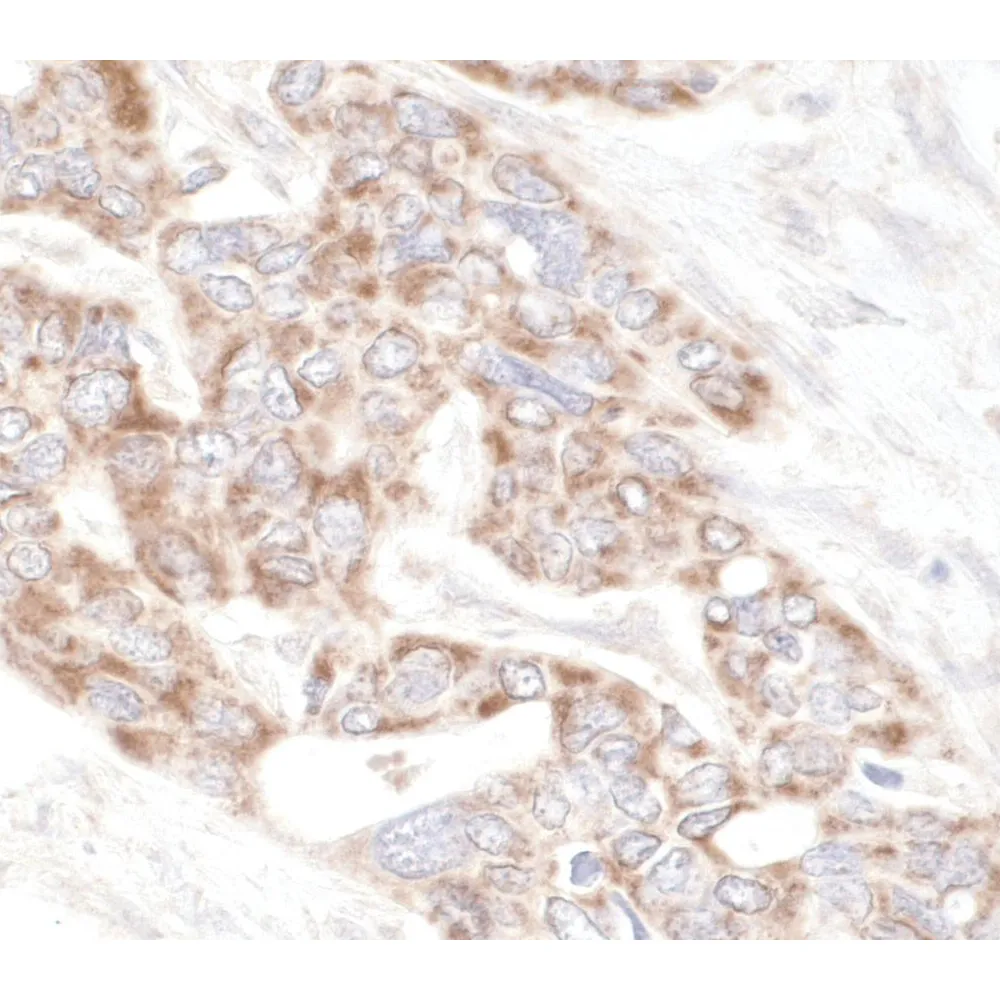Rabbit anti-PDZ-GEF1 IHC Antibody, Affinity Purified