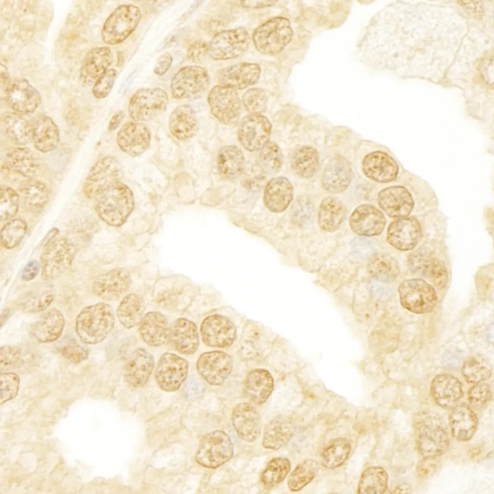 Rabbit anti-ANKRD17 IHC Antibody, Affinity Purified