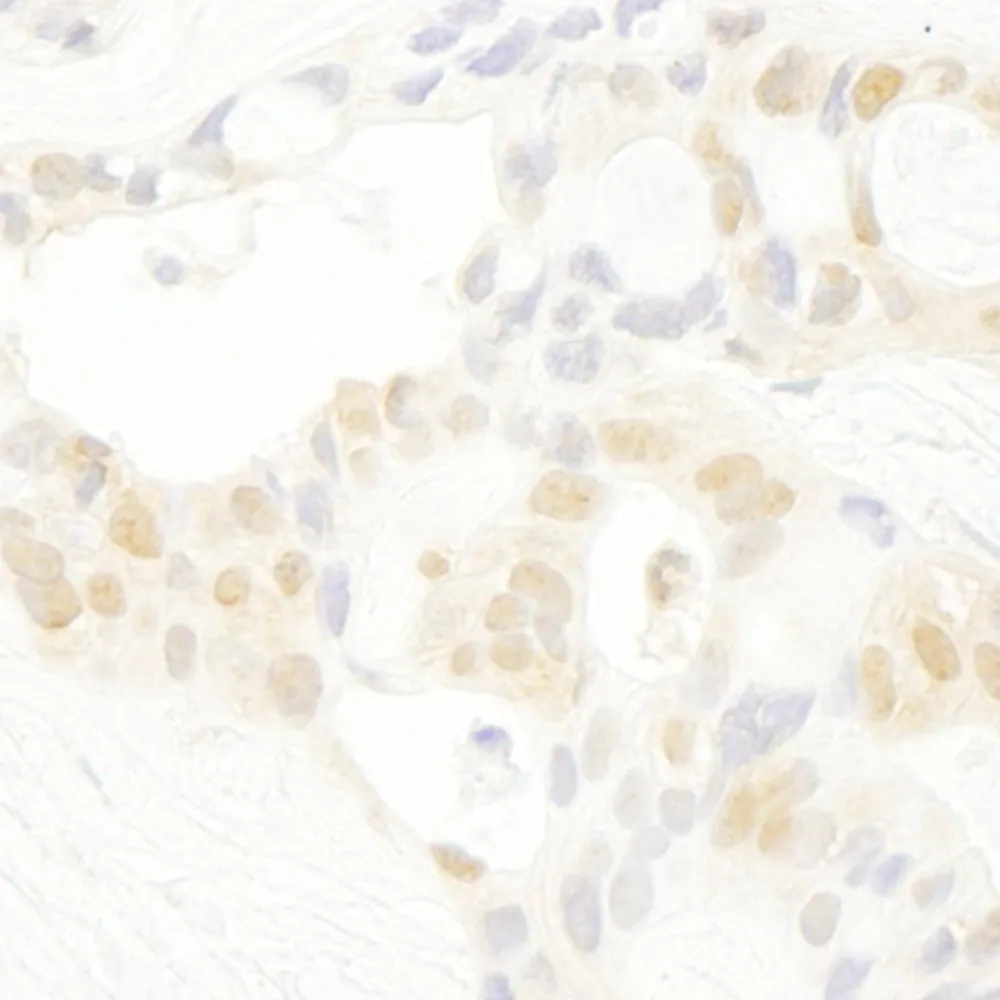 Rabbit anti-PRPF4B IHC Antibody, Affinity Purified