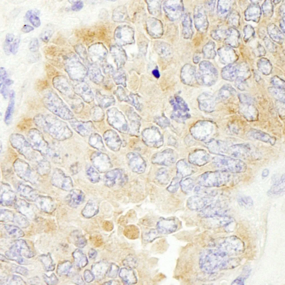 Rabbit anti-eIF2beta/EIF2S2 IHC Antibody, Affinity Purified