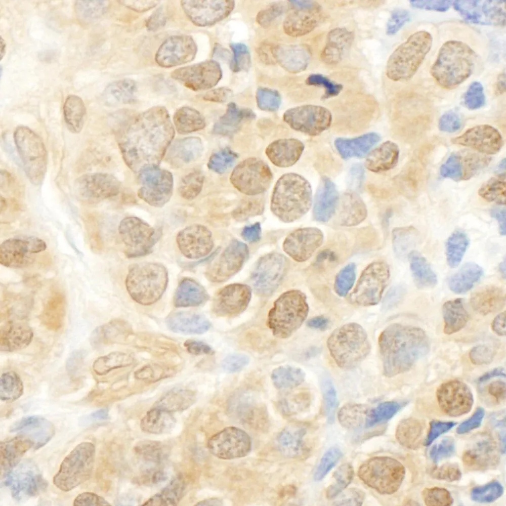 Rabbit anti-MEK1 IHC Antibody, Affinity Purified