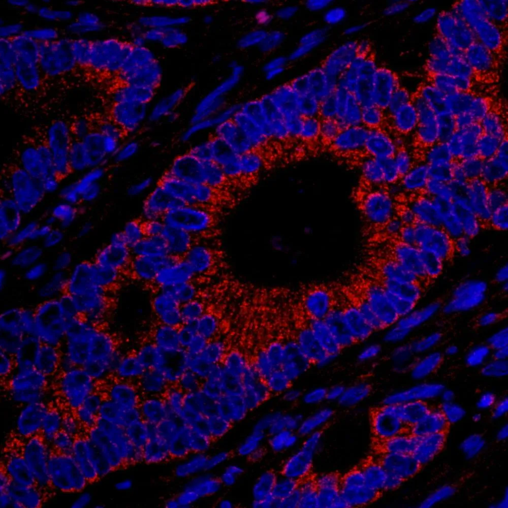 Rabbit anti-MADD IHC Antibody, Affinity Purified