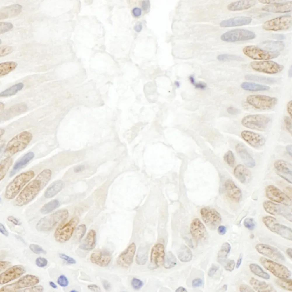 Rabbit anti-BCCIP IHC Antibody, Affinity Purified