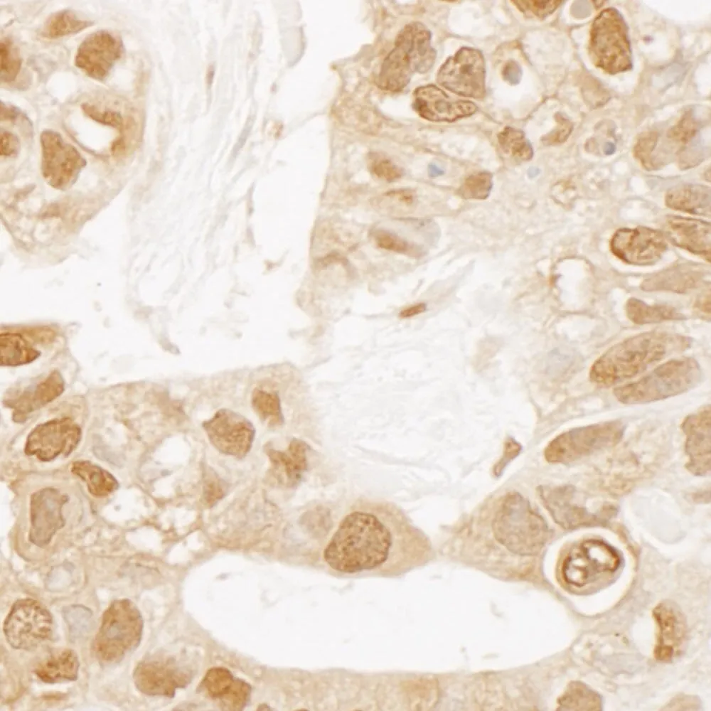 Rabbit anti-TIGAR IHC Antibody, Affinity Purified