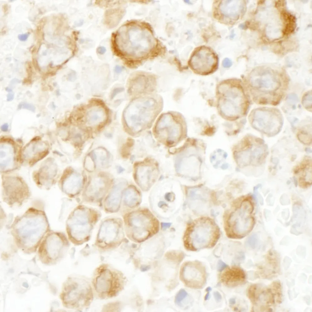 Rabbit anti-CKAP4 IHC Antibody, Affinity Purified