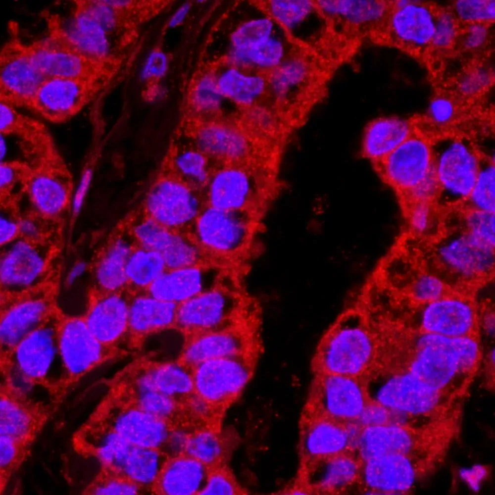 Rabbit anti-YAP1 IHC Antibody, Affinity Purified