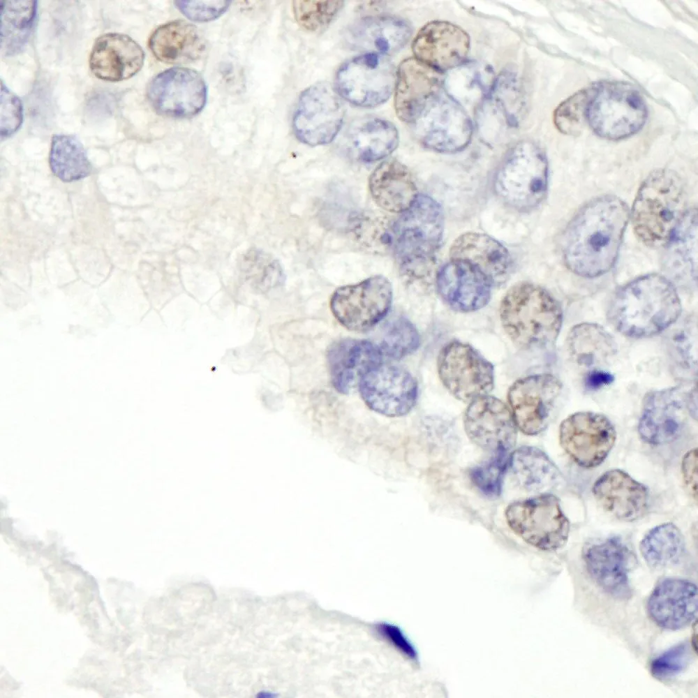 Rabbit anti-BRD3 IHC Antibody, Affinity Purified