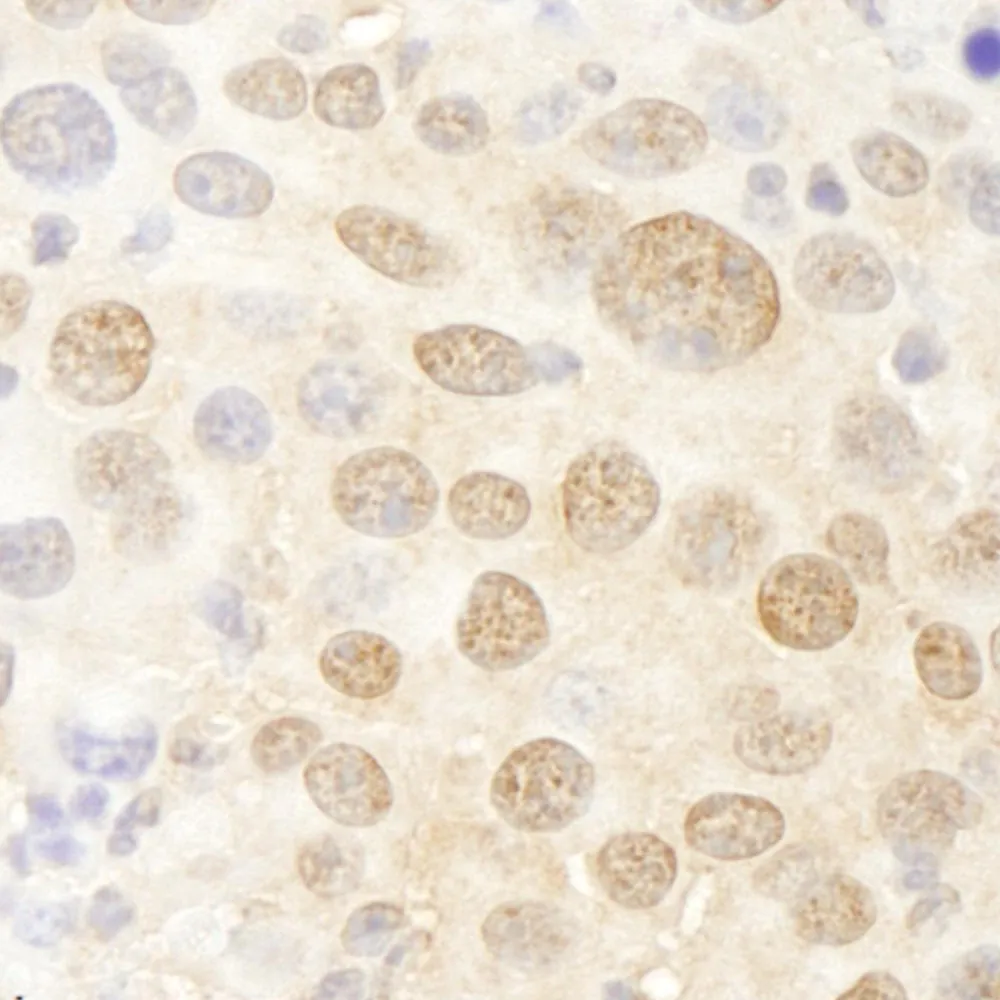 Rabbit anti-Pc2 IHC Antibody, Affinity Purified