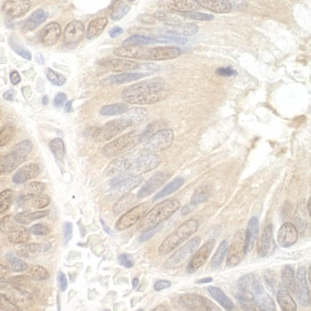Rabbit anti-EAF2 IHC Antibody, Affinity Purified