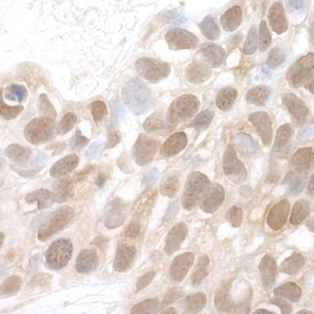 Rabbit anti-MERIT40 IHC Antibody, Affinity Purified