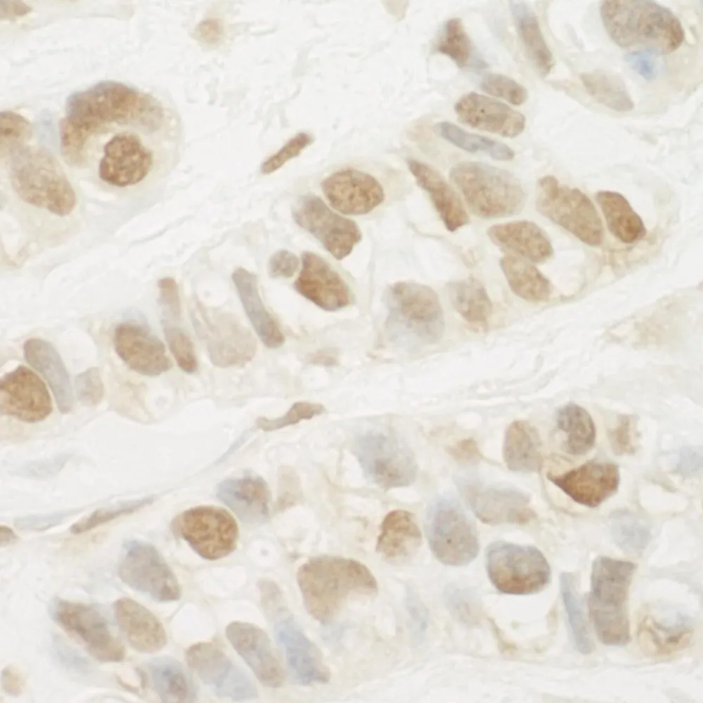 Rabbit anti-MED13L IHC Antibody, Affinity Purified