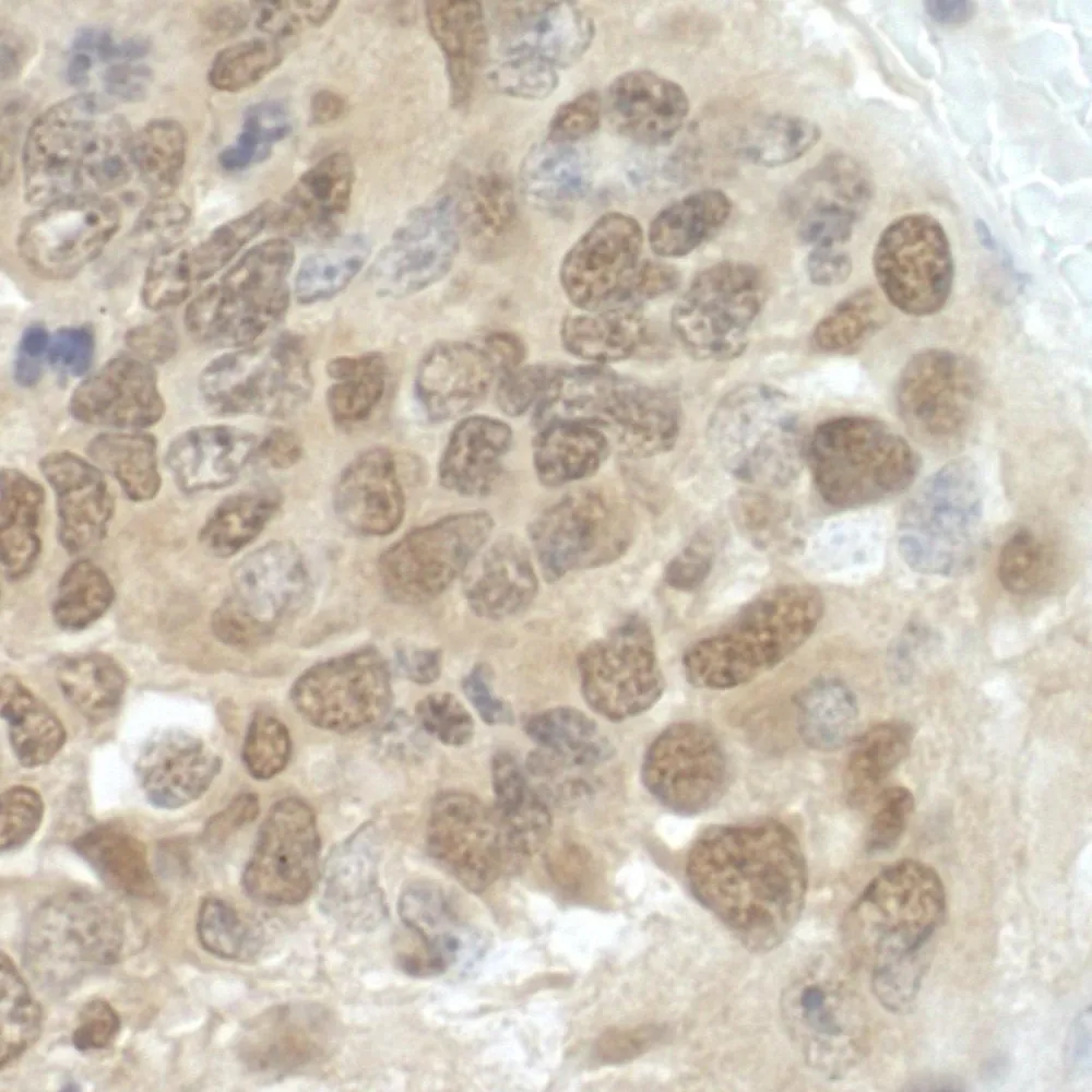 Rabbit anti-CDC6 IHC Antibody, Affinity Purified