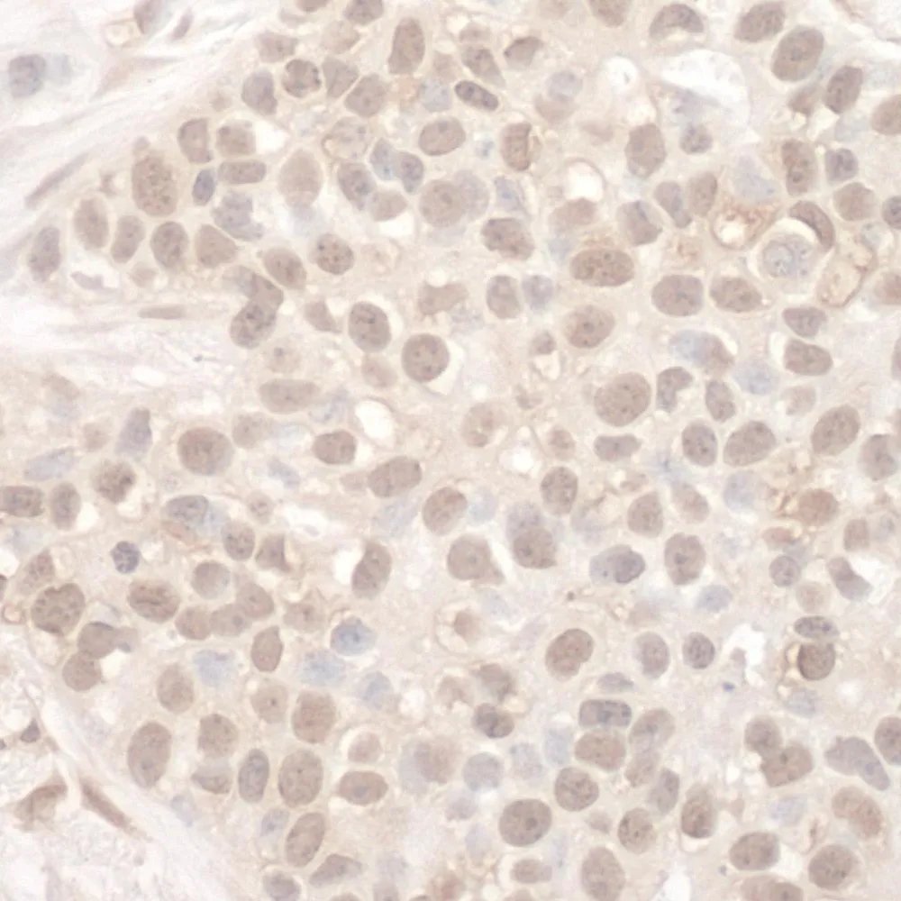 Rabbit anti-EYA2 IHC Antibody, Affinity Purified