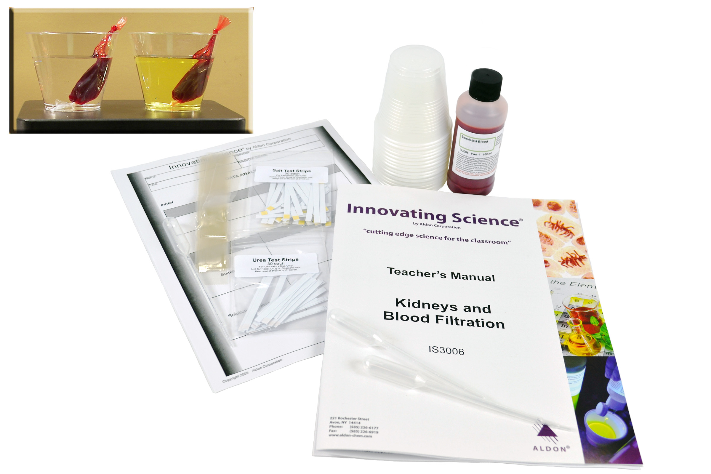 Kidneys And Blood Filtration Lab Activity
