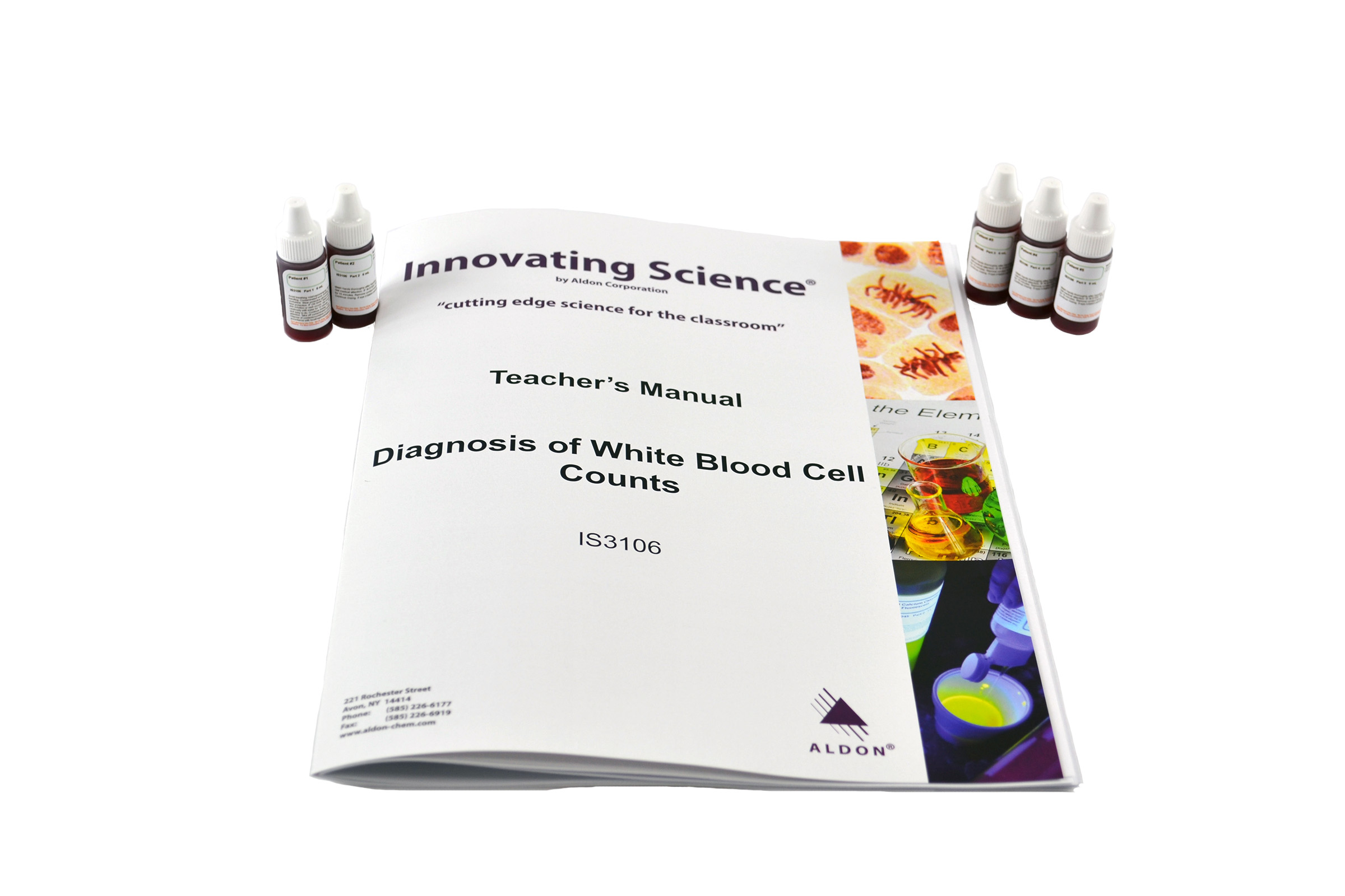 Diagnosis Of White Blood Cell Counts