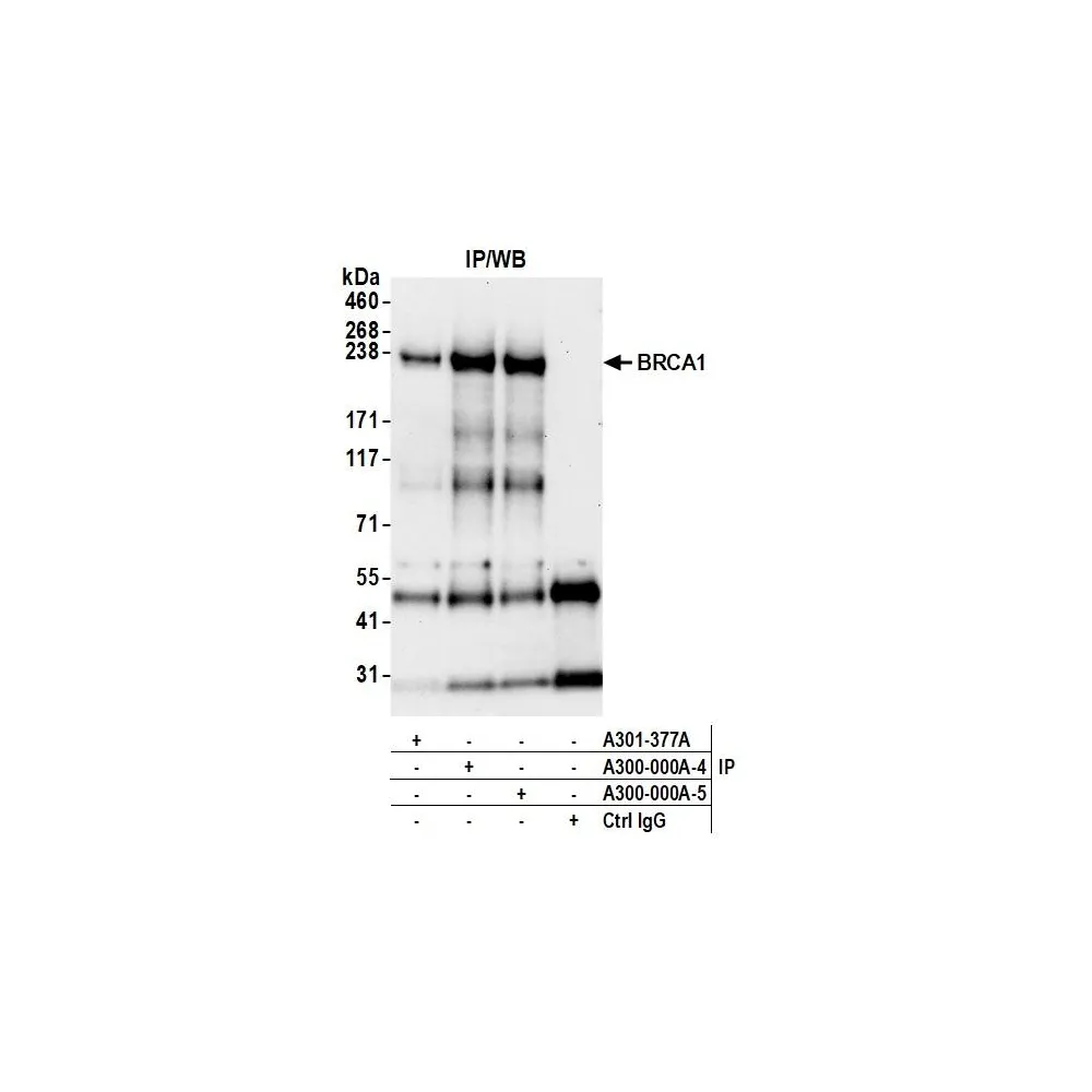 Rabbit anti-BRCA1 Antibody, Affinity Purified