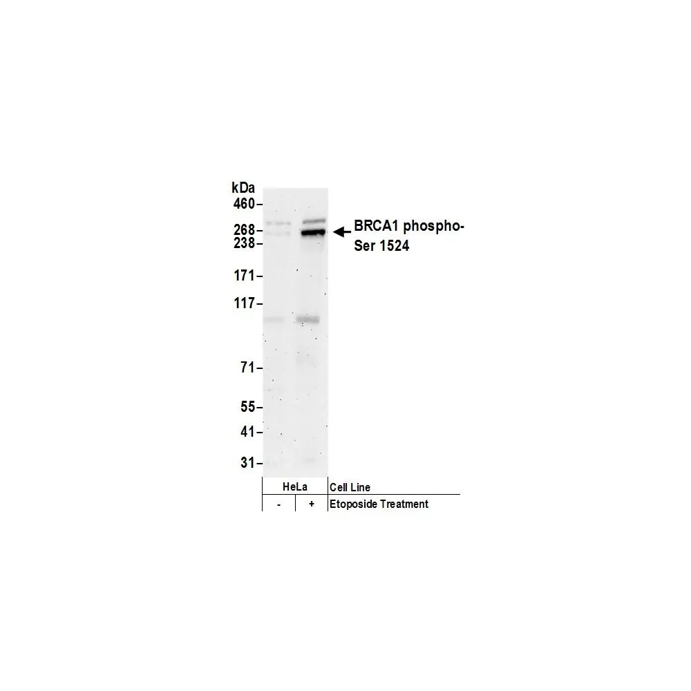 Rabbit anti-Phospho BRCA1 (S1524) Antibody, Affinity Purified