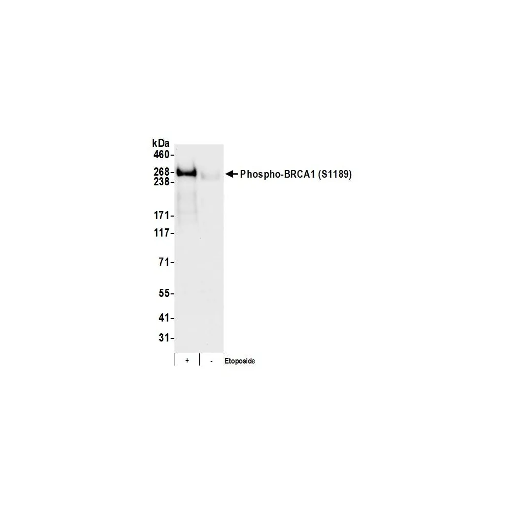 Rabbit anti-Phospho BRCA1 (S1189) Antibody, Affinity Purified