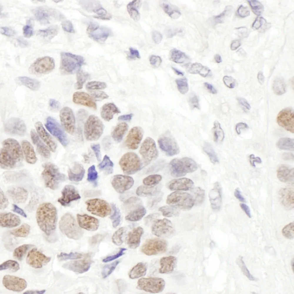Goat anti-MSH6 Antibody, Affinity Purified