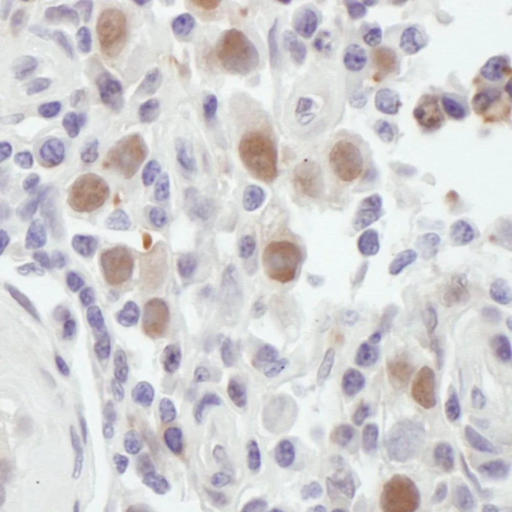 Rabbit anti-MSH6 Antibody, Affinity Purified
