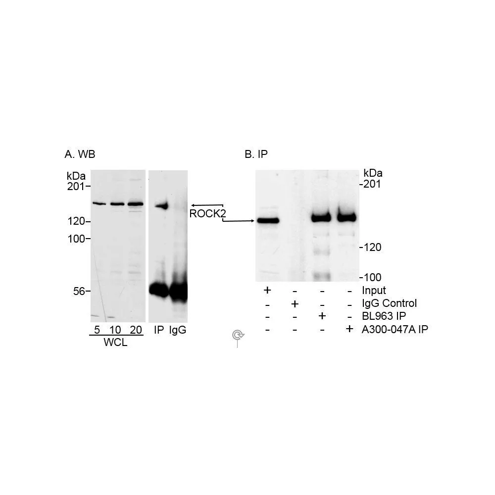 Rabbit anti-ROCK2 Antibody, Affinity Purified