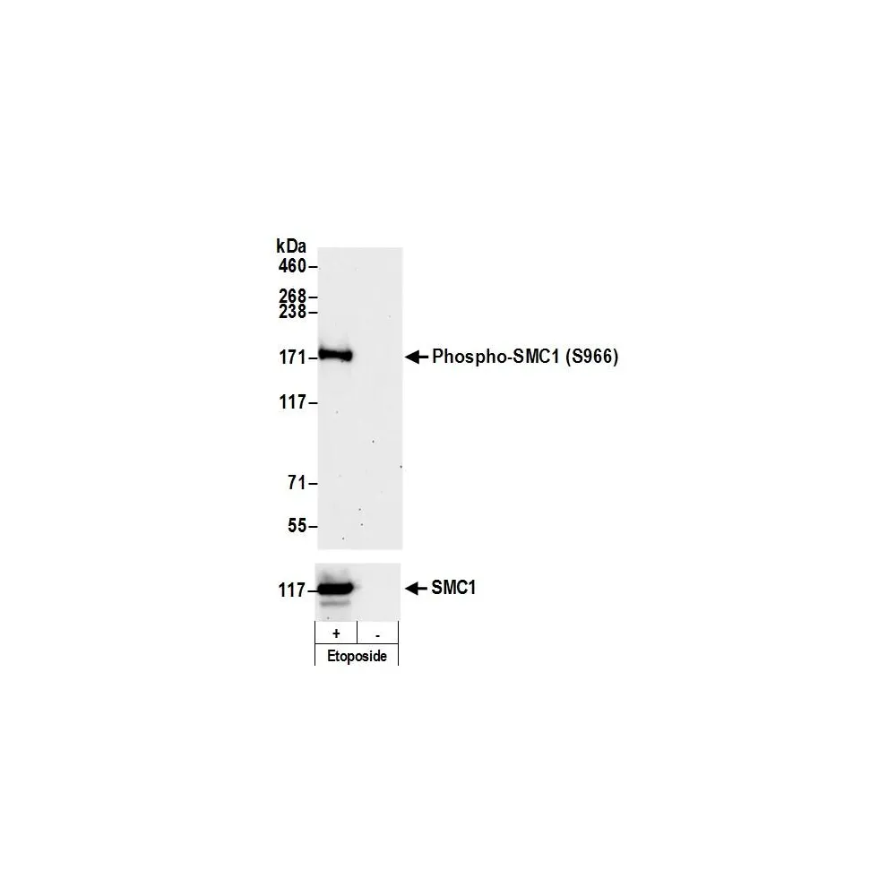 Rabbit anti-Phospho SMC1 (S966) Antibody, Affinity Purified