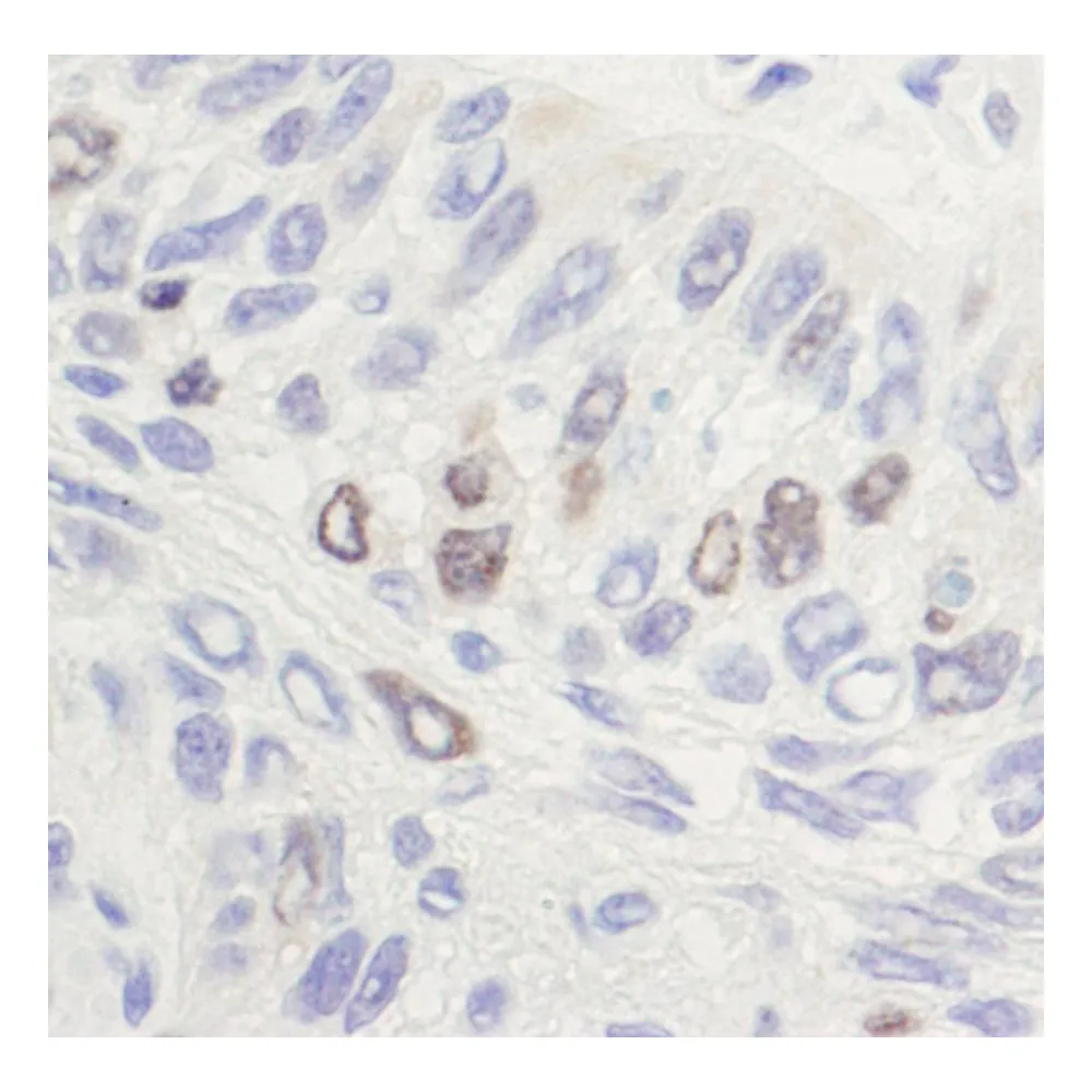 Rabbit anti-Topo II Alpha Antibody, Affinity Purified