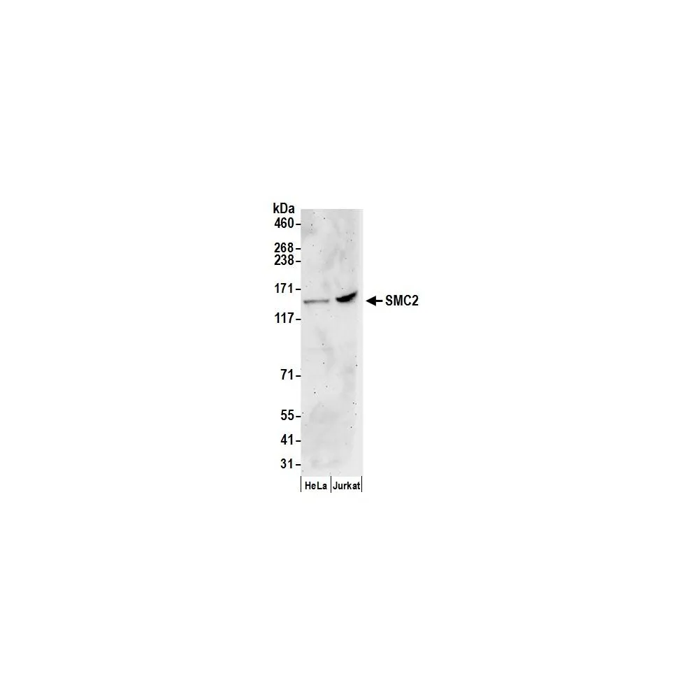 Rabbit anti-SMC2 Antibody, Affinity Purified