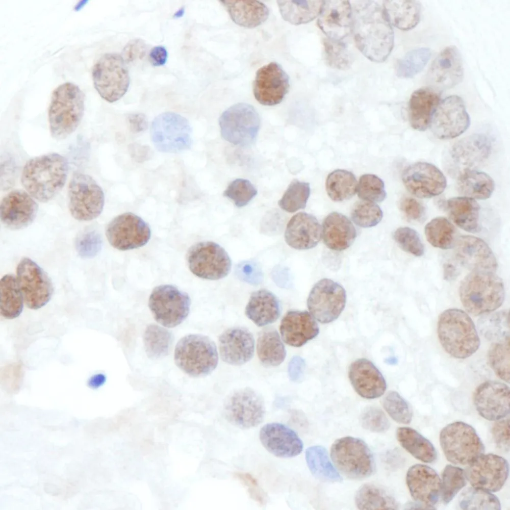 Rabbit anti-Phospho XRCC1 (S518/T519/T523) Antibody, Affinity Purified
