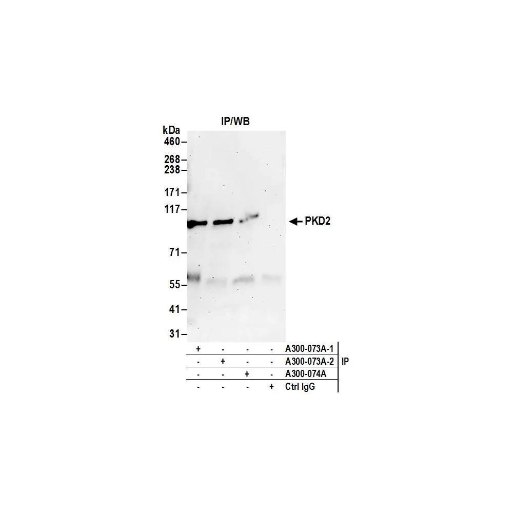 Rabbit anti-PKD2 Antibody, Affinity Purified