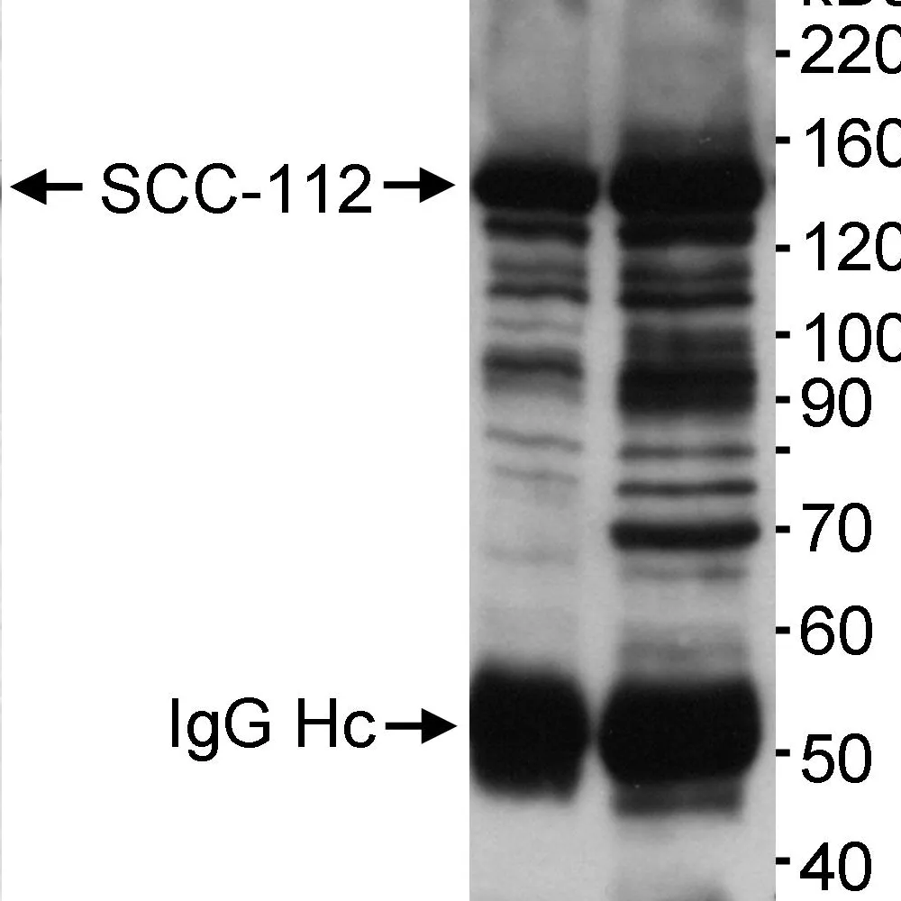 Rabbit anti-SCC-112 Antibody, Affinity Purified
