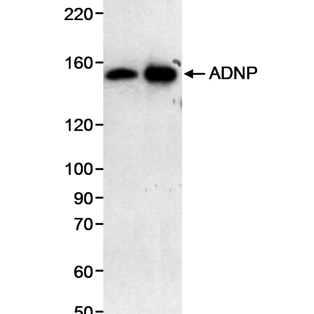 Rabbit anti-ADNP Antibody, Affinity Purified