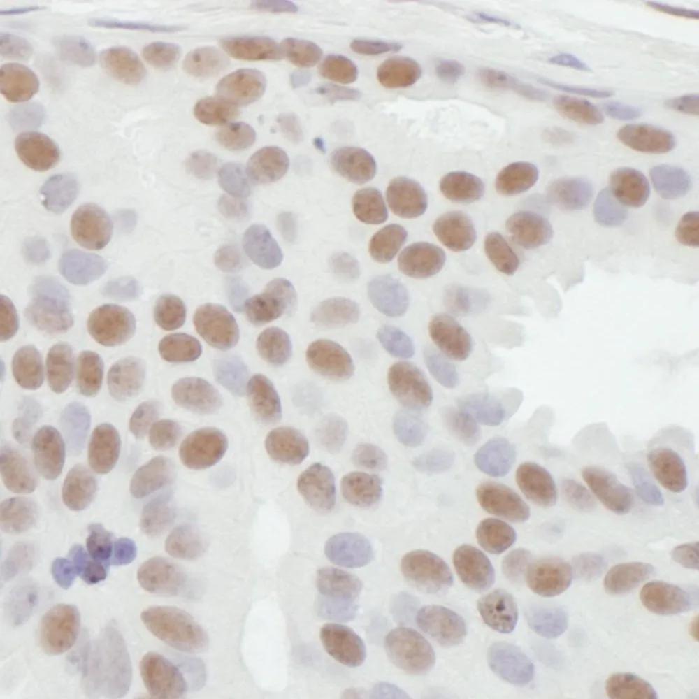 Rabbit anti-ASH2 Antibody, Affinity Purified