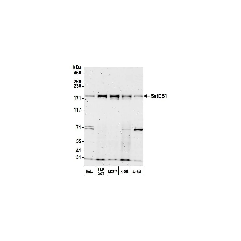Rabbit anti-SETDB1 Antibody, Affinity Purified