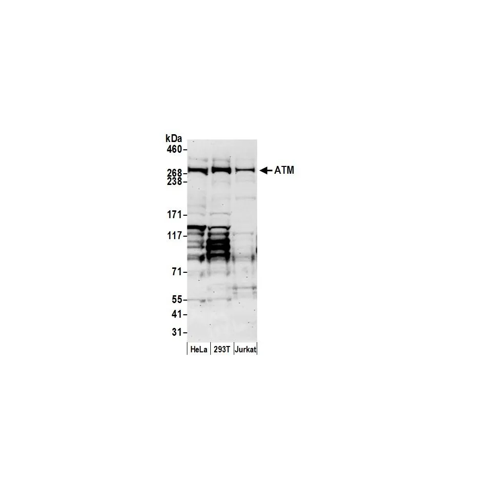 Goat anti-ATM Antibody, Affinity Purified