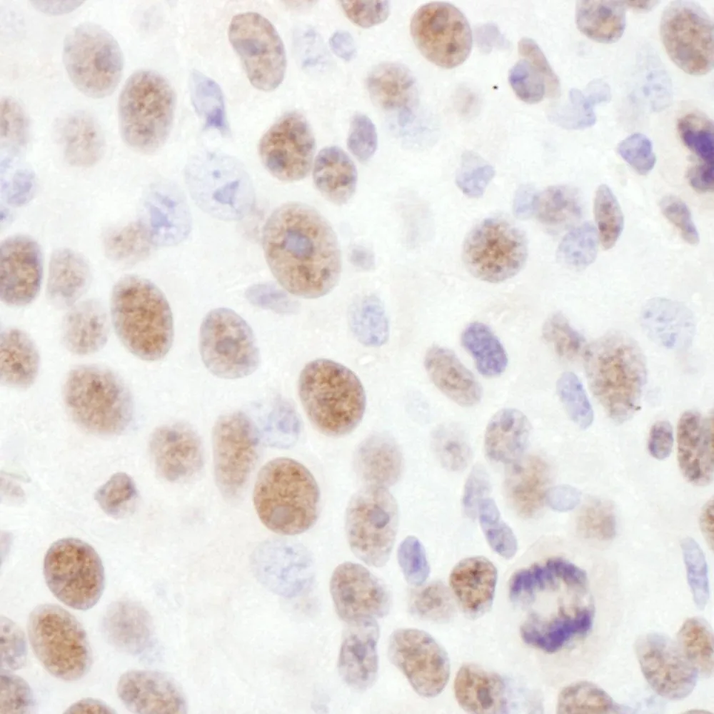 Rabbit anti-Phospho Rad17 (S645) Antibody, Affinity Purified