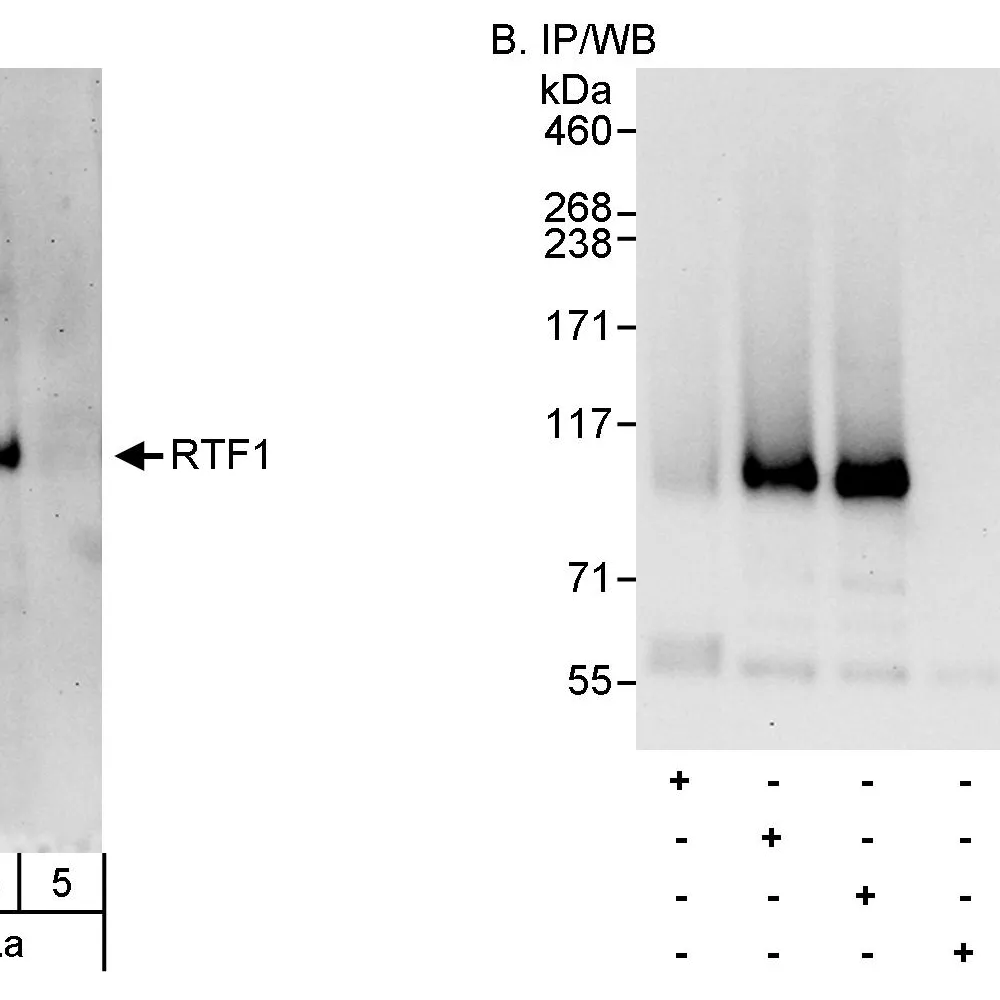 Rabbit anti-Rtf1 Antibody, Affinity Purified