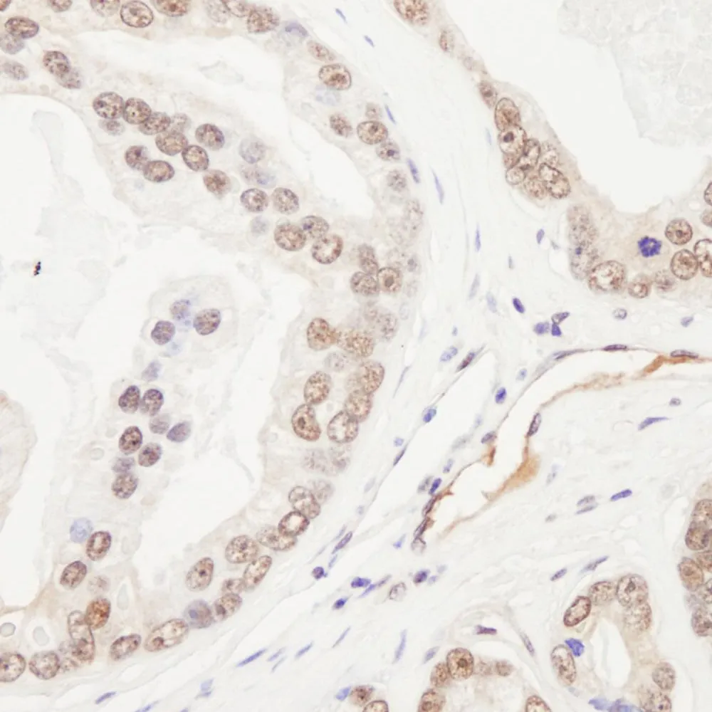 Rabbit anti-Rad50 Antibody, Affinity Purified