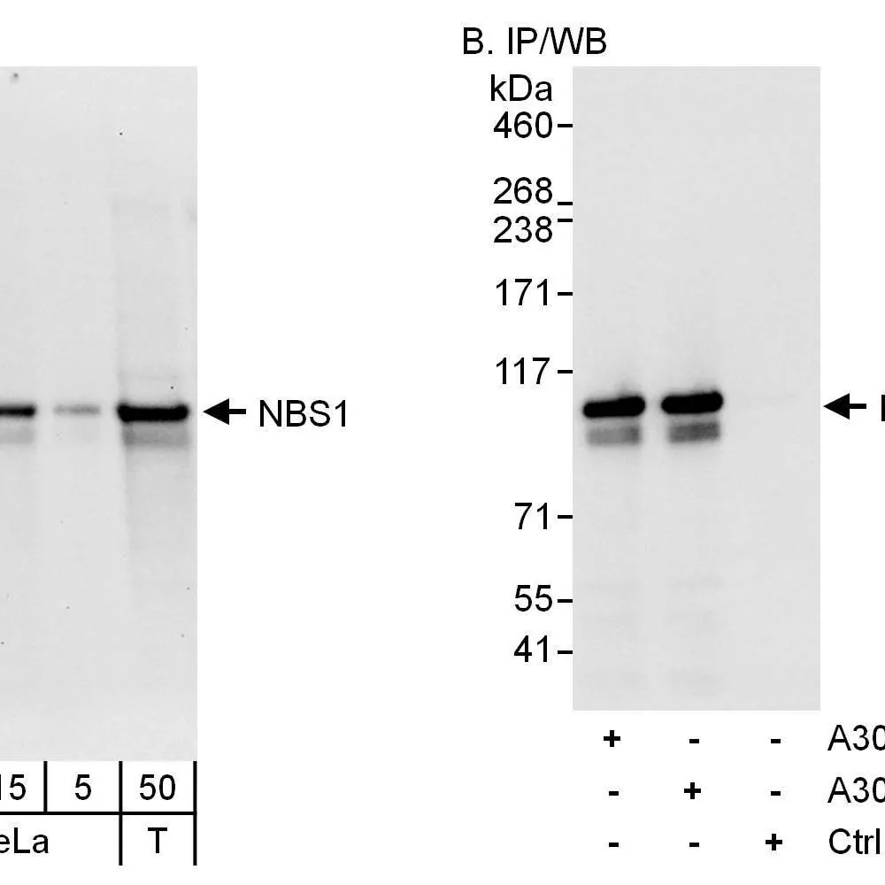 Rabbit anti-NBS1 Antibody, Affinity Purified