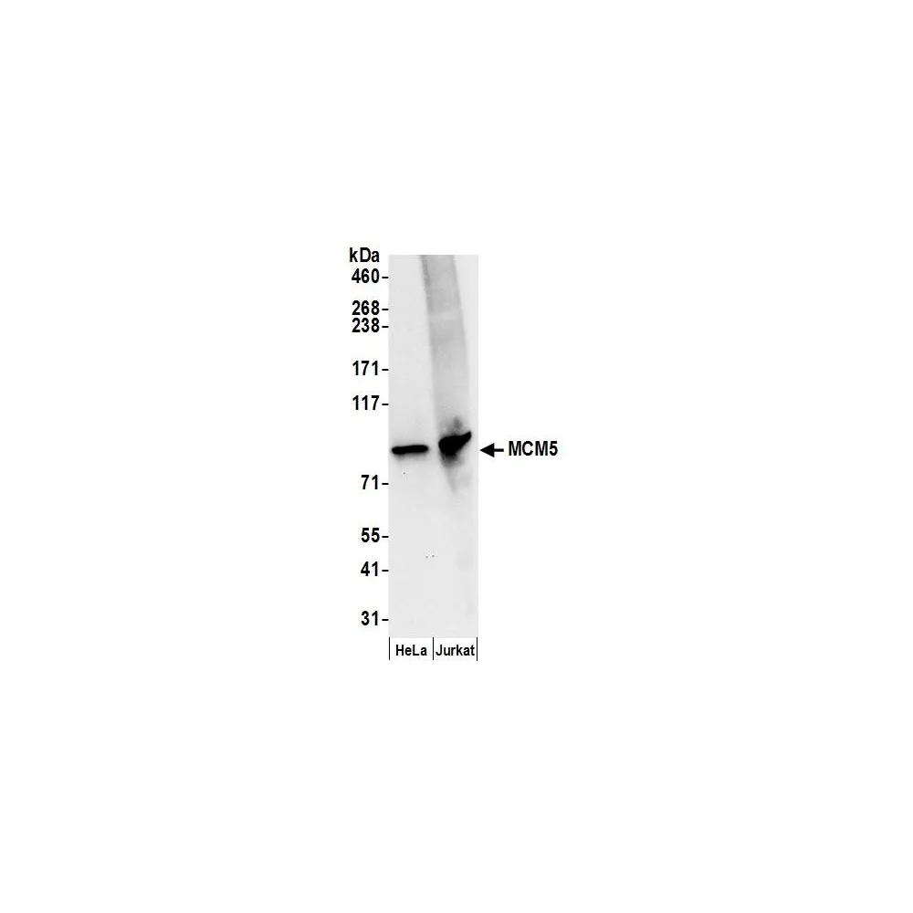 Rabbit anti-MCM5 Antibody, Affinity Purified