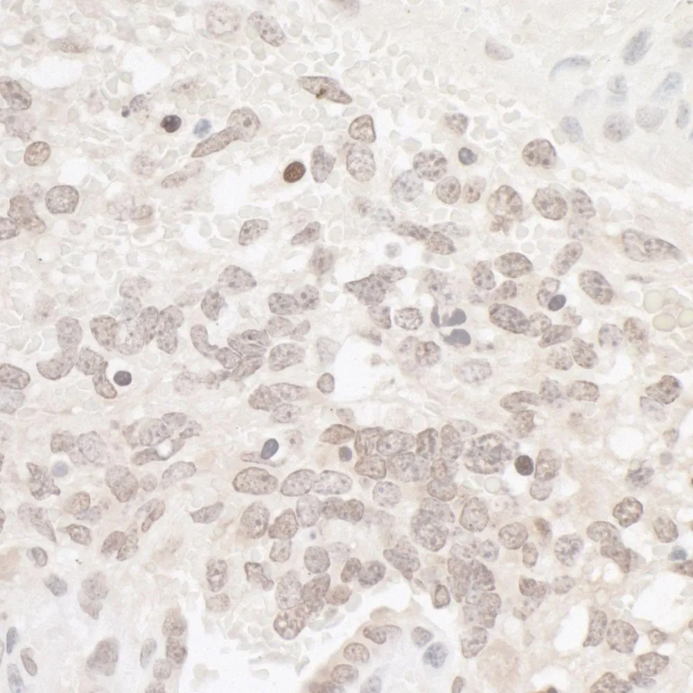 Rabbit anti-CKII alpha Antibody, Affinity Purified