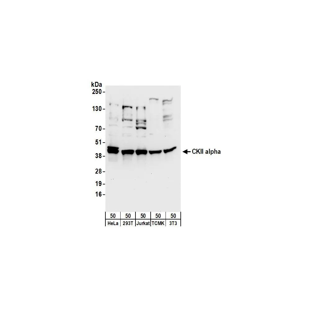 Rabbit anti-CKII alpha Antibody, Affinity Purified